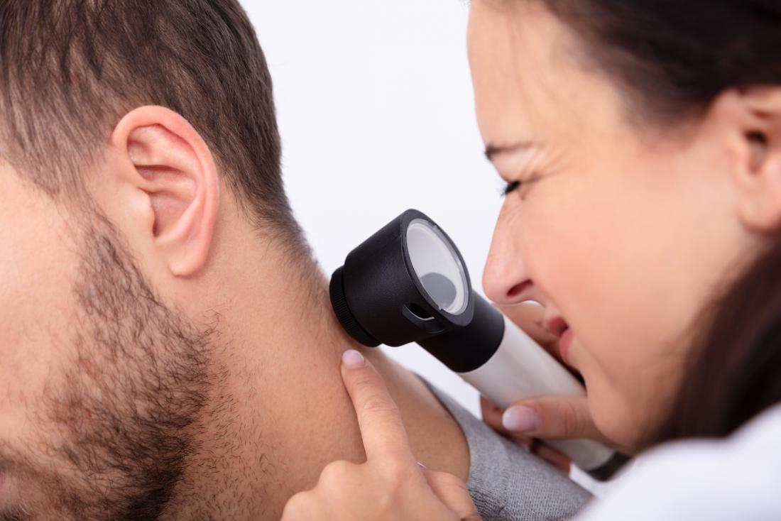 Doctor checking melanoma