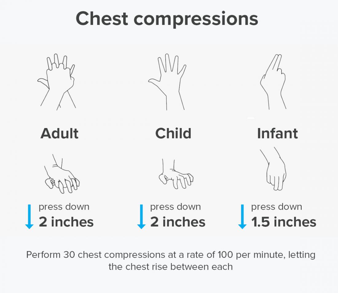 Chest compressions in CPR visual guide infographic
