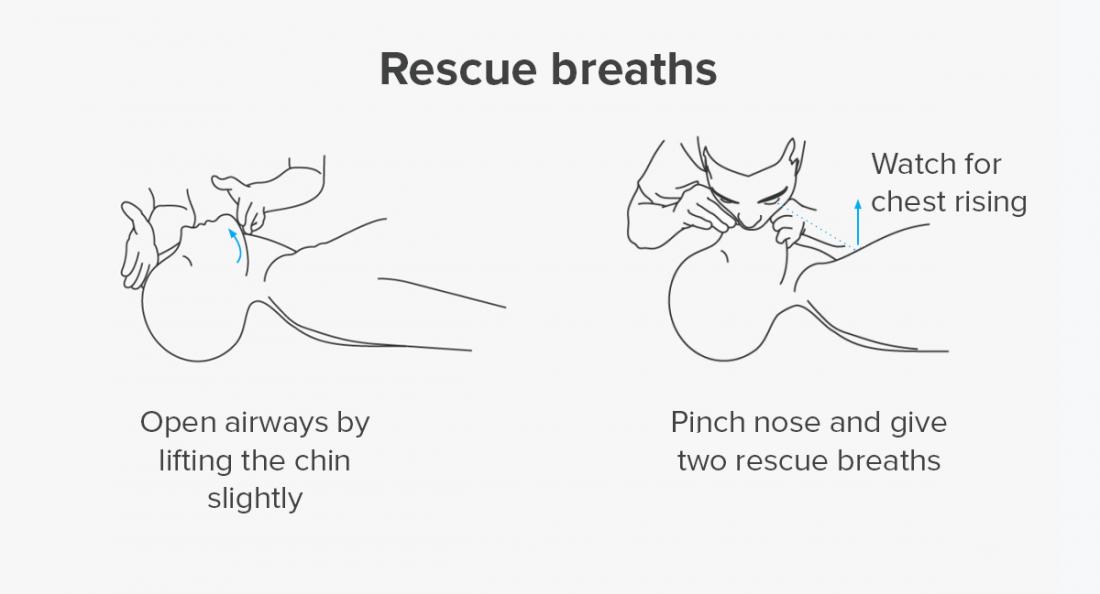 [HEALTH TIPS] What to do when someone faints and how to perform CPR