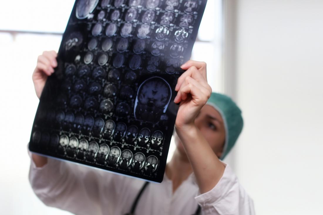 doctor looking at brain scans