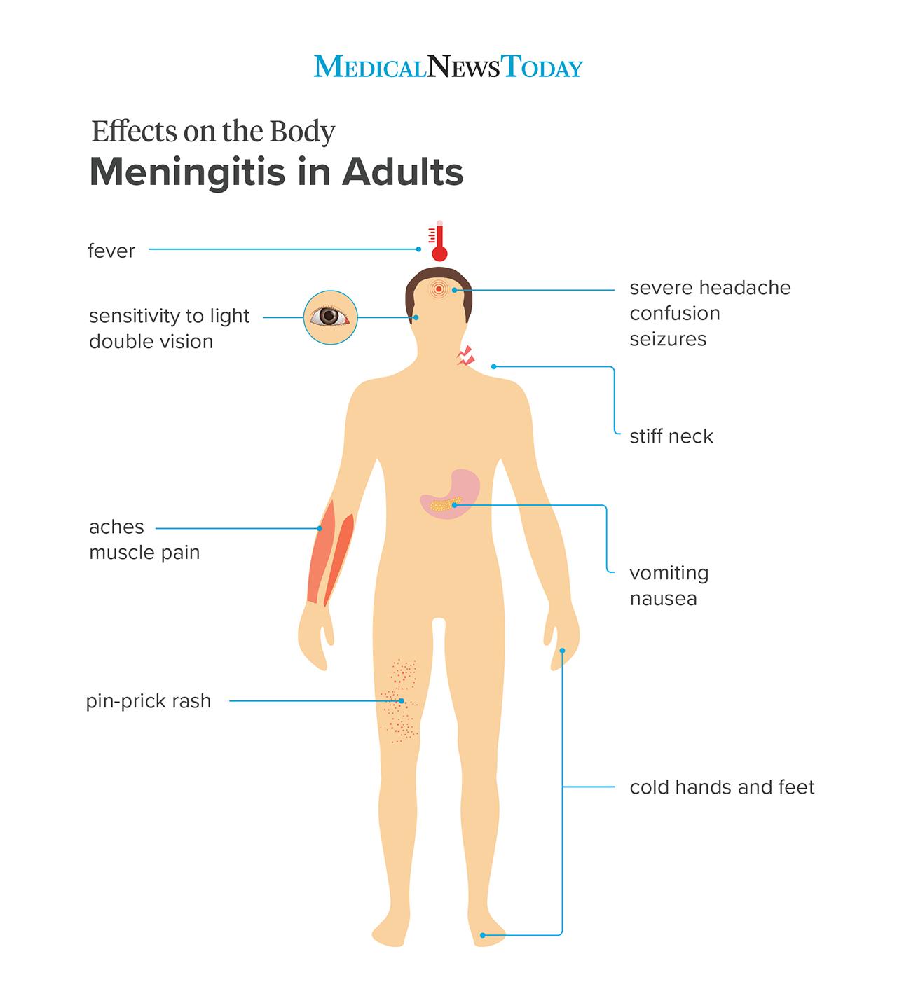 Meningitis rash Pictures, symptoms, and similar rashes