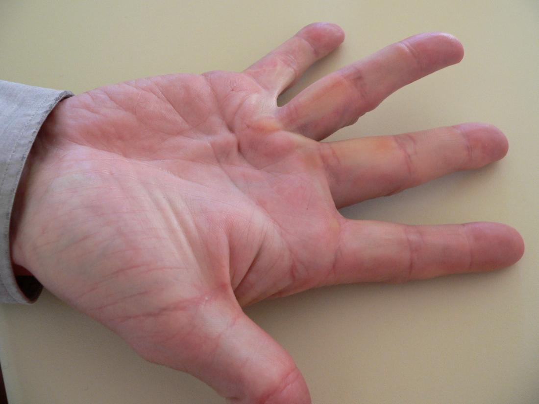 Why Do My Hands Hurt? 5 Reasons for the Pain | Ochsner Health