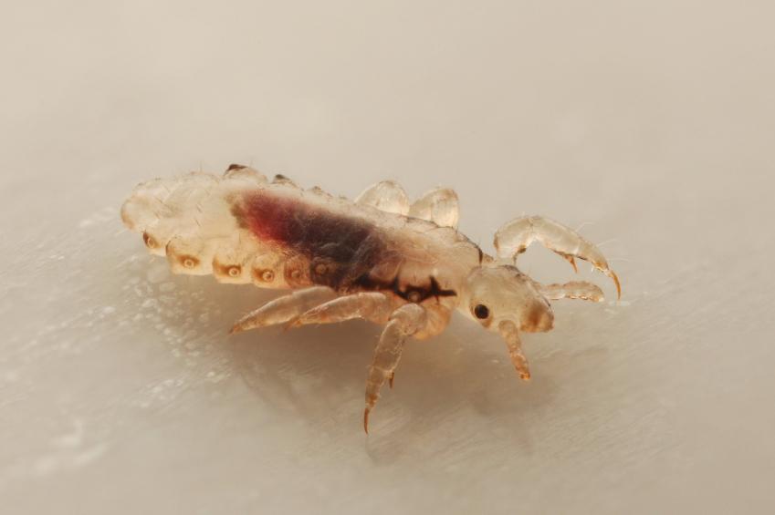 What Do Head Lice Look Like Symptoms And Pictures