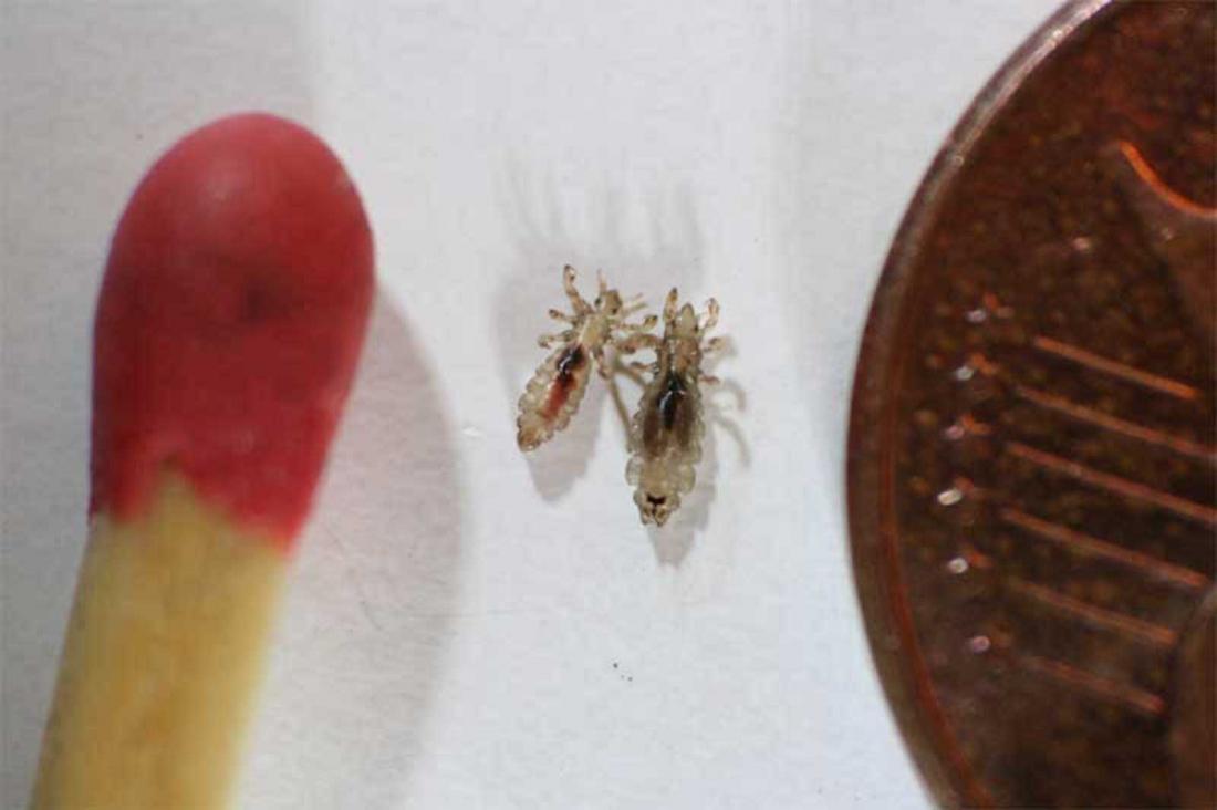 Head Lice Scaled Next To A Match And A Coin Br Image Credit Pediculosis 2007 Br 