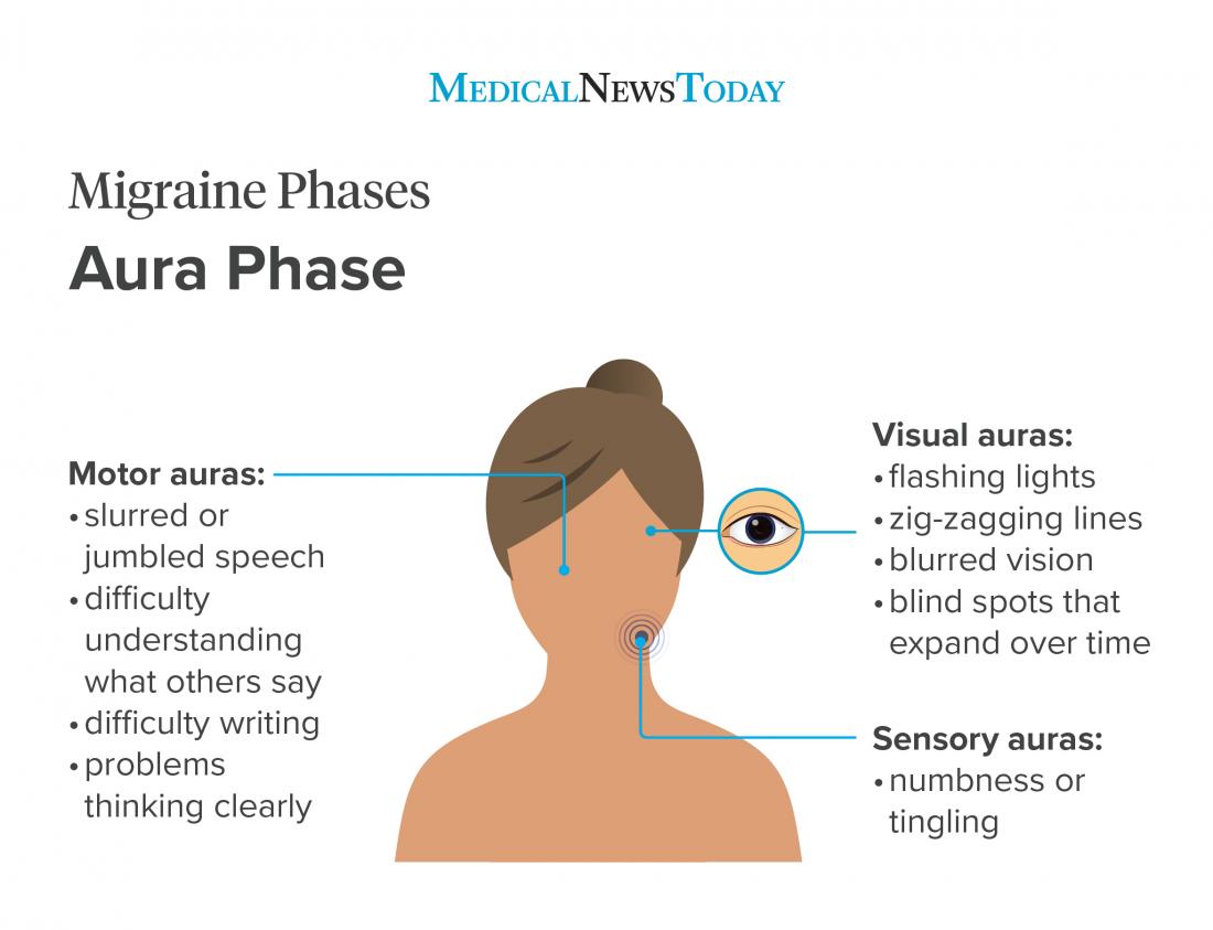 Migraine phase infographic Aura phase <br>Image credit: Stephen Kelly, 2019</br>