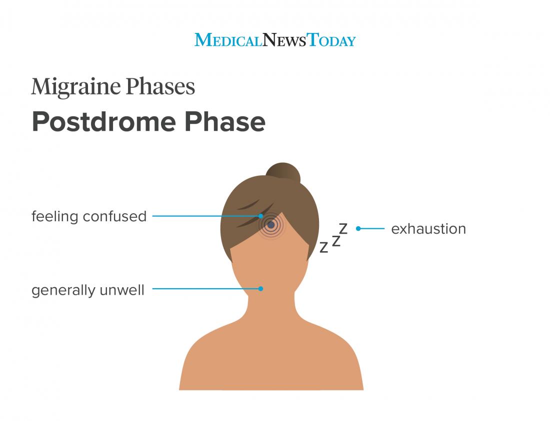 Migraine phases infographic - Headache phase <br>Image credit: Stephen Kelly, 2019</br><!--mce:protected %0A-->