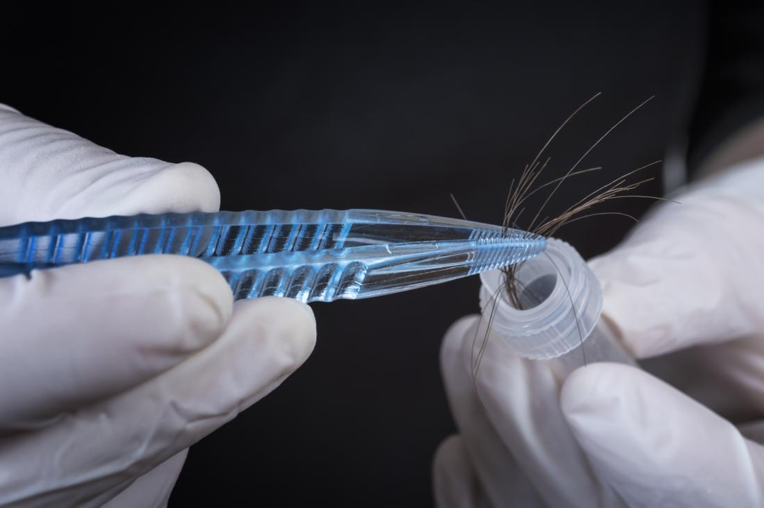 Hair follicle drug test How it works, what to expect, and accuracy