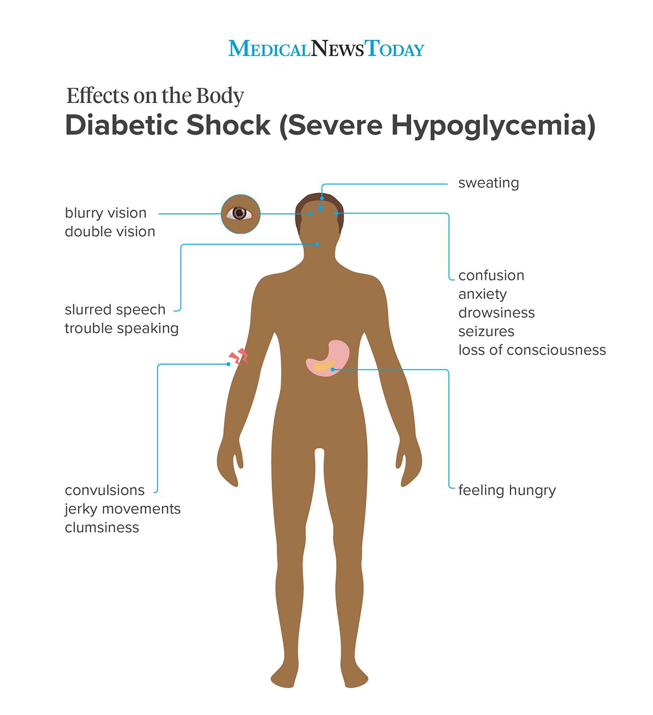 Symptons of shock