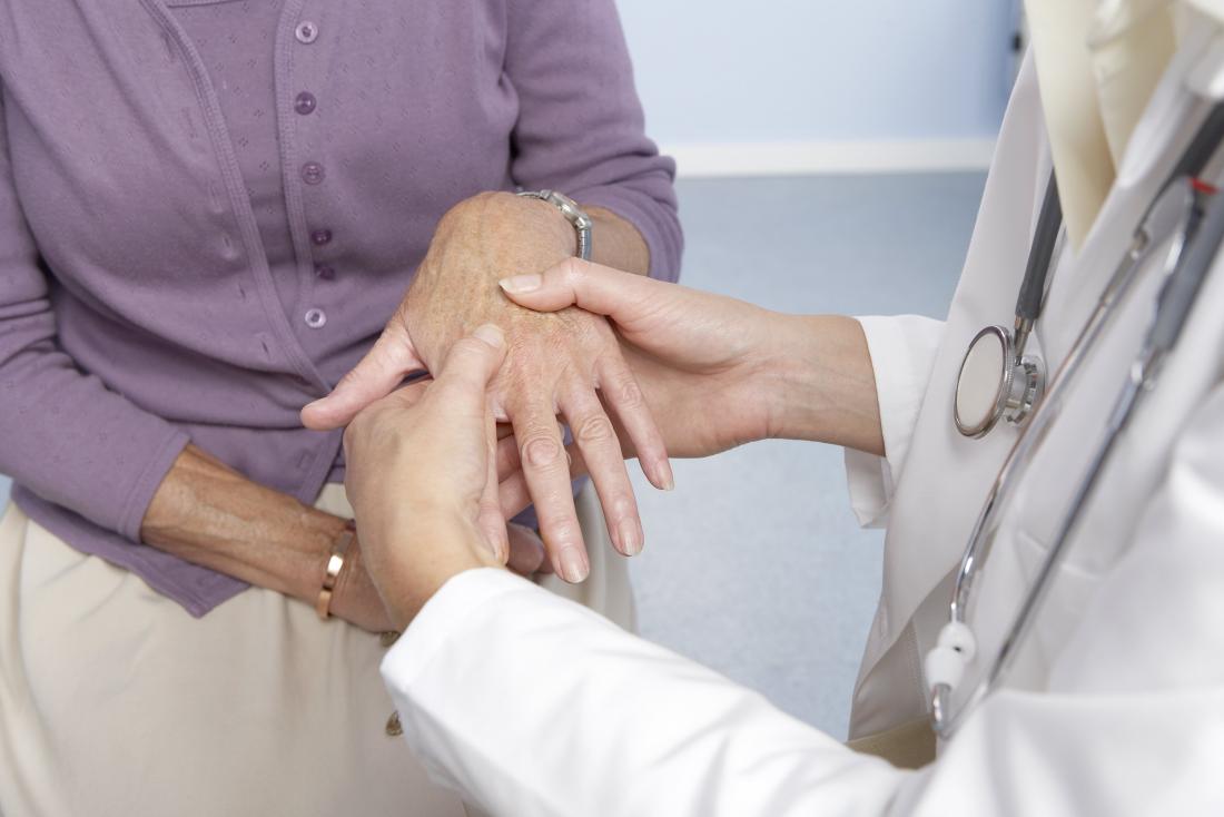 doctor checking for signs of rheumatoid arthritis