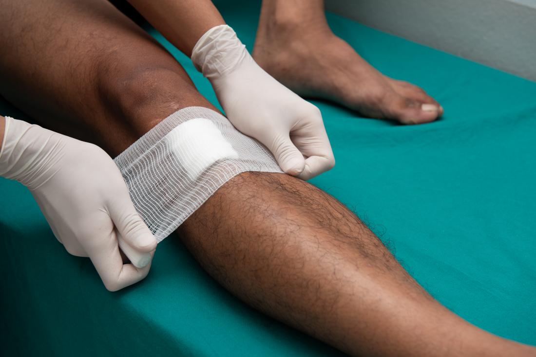 Open wound care: Types, risks, and treatment