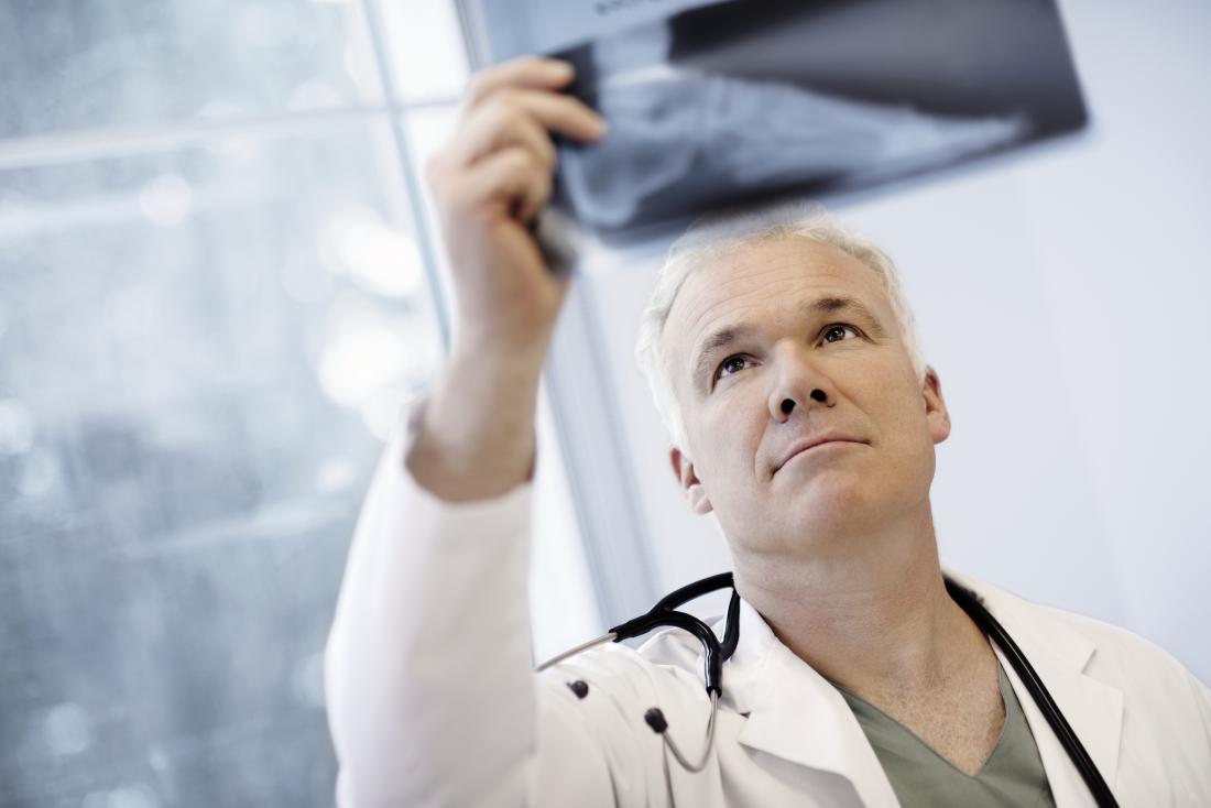 Imaging tests, such as X-rays, can help a doctor to diagnose rheumatoid arthritis accurately.