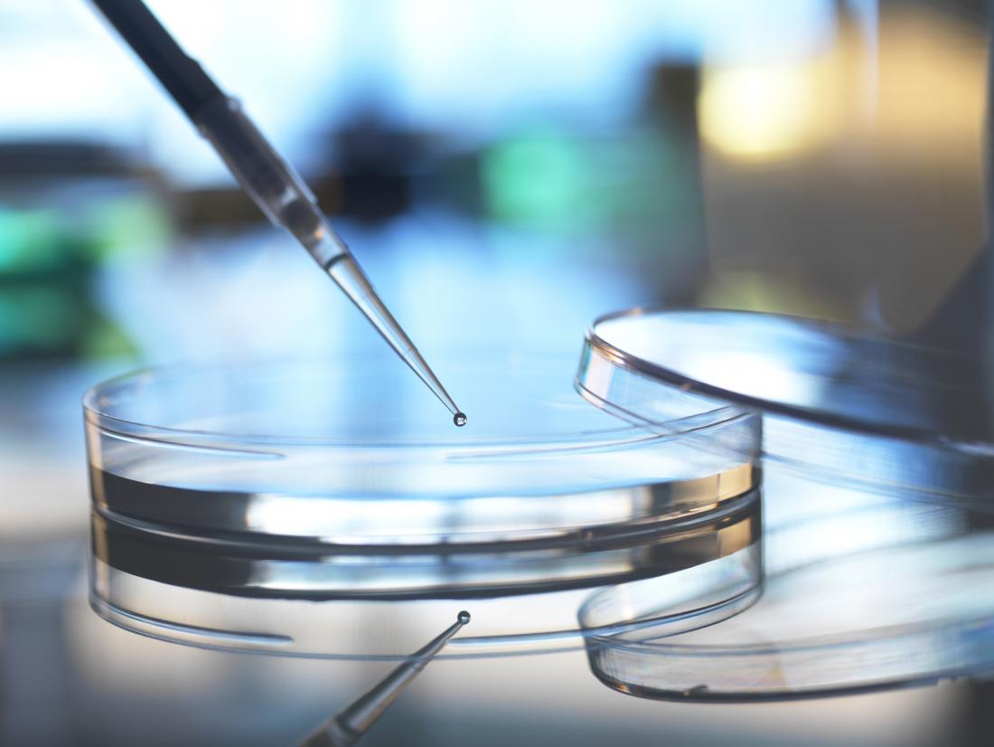 A petri dish used for stem cell therapy of rheumatoid arthritis.