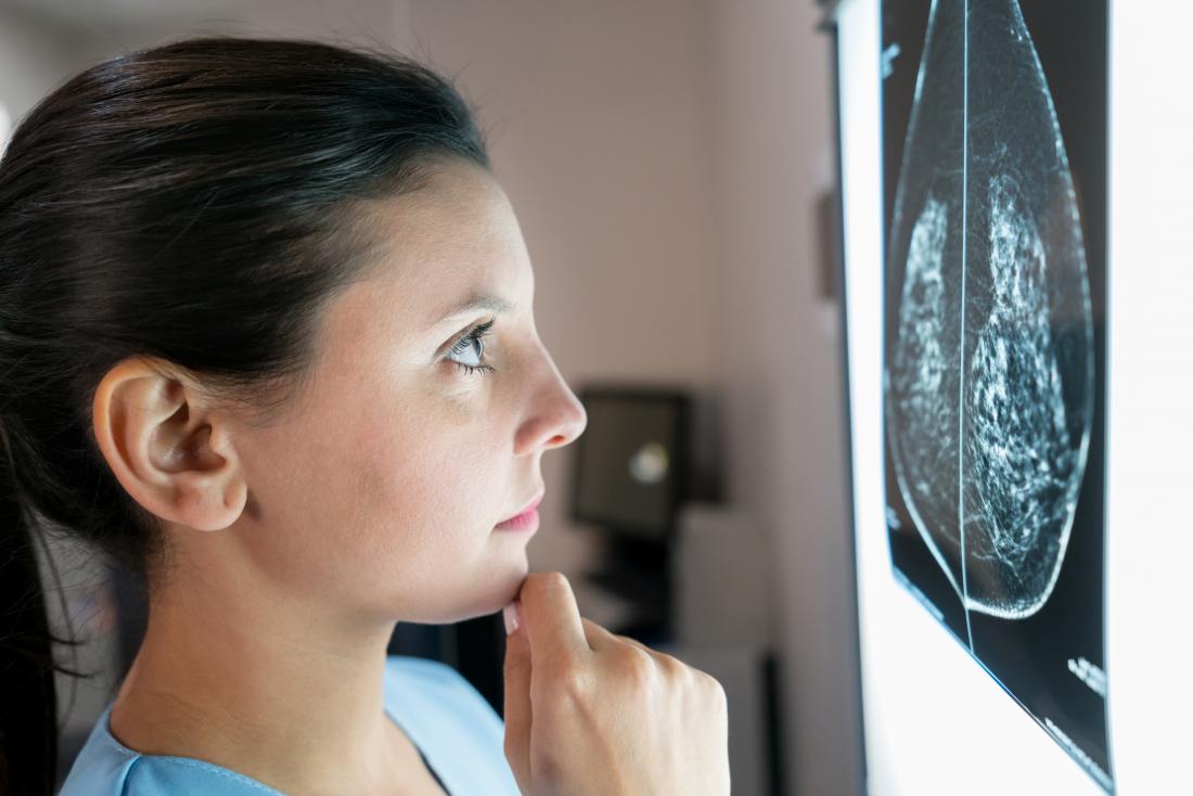 A doctor looking at mammogram to compare it to the tumor size chart. 