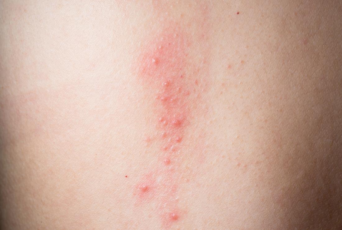 red itchy bumps on forearm