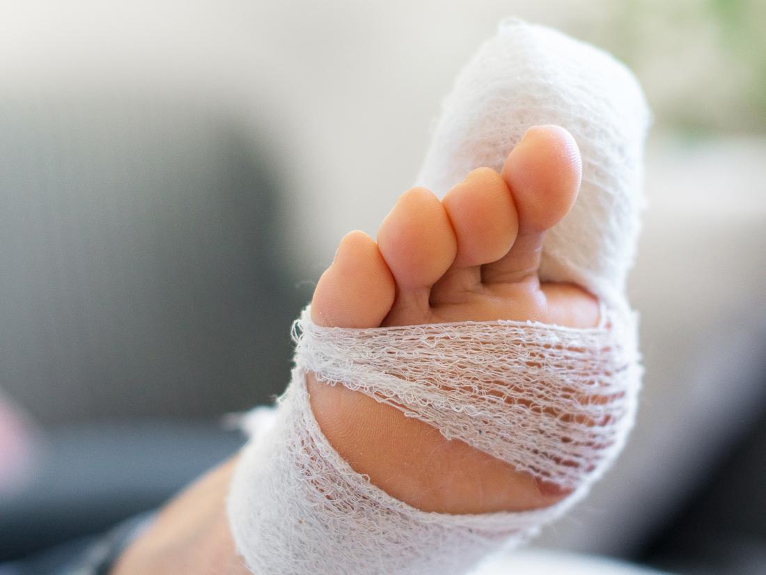 Stubbed toe When is it serious, and what are the treatments?