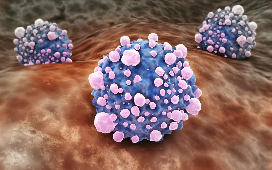 pancreatic cancer cells illustration