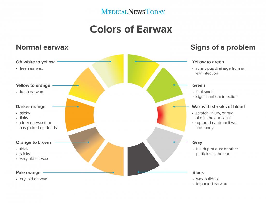 discharge color chart