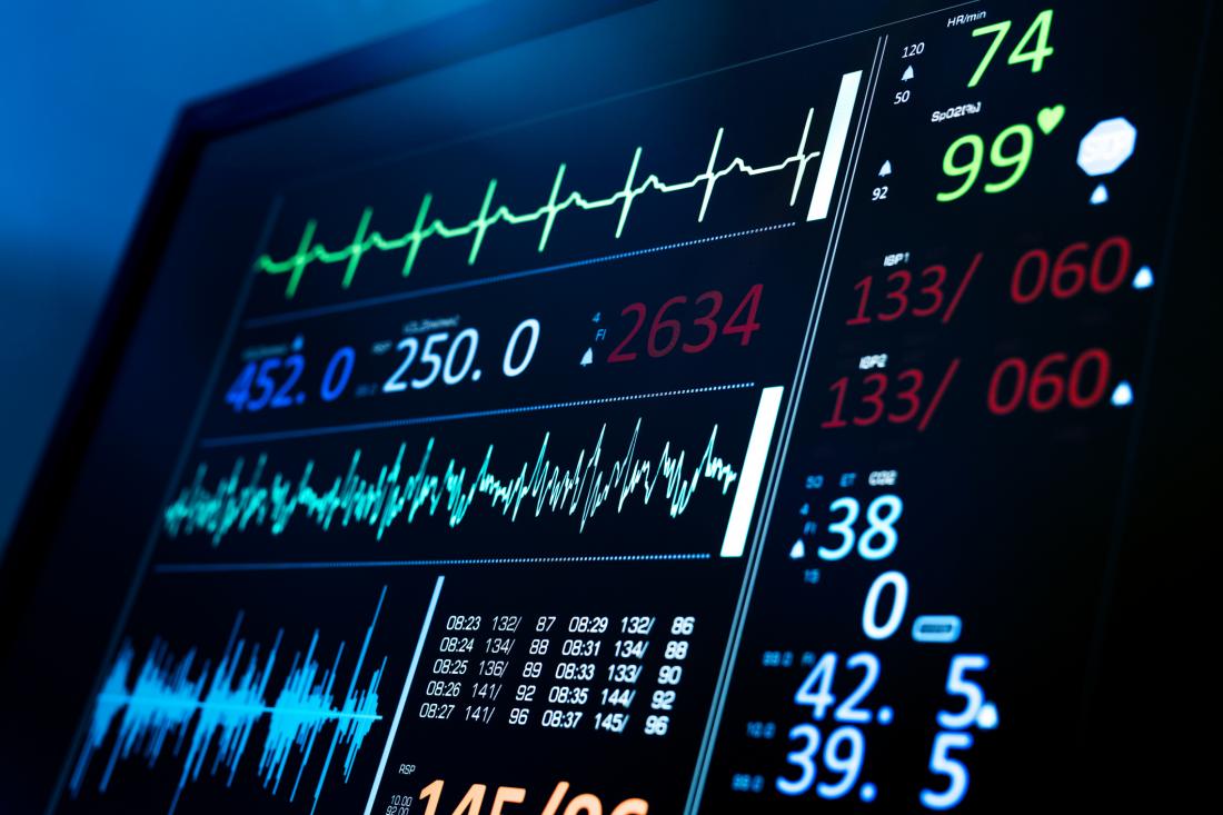 ai-enhanced-ecgs-may-soon-assess-overall-health-earth-news-report