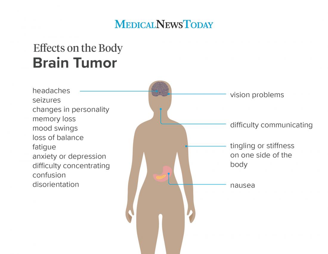 early-symptoms-of-a-brain-tumor-mental-and-physical-signs