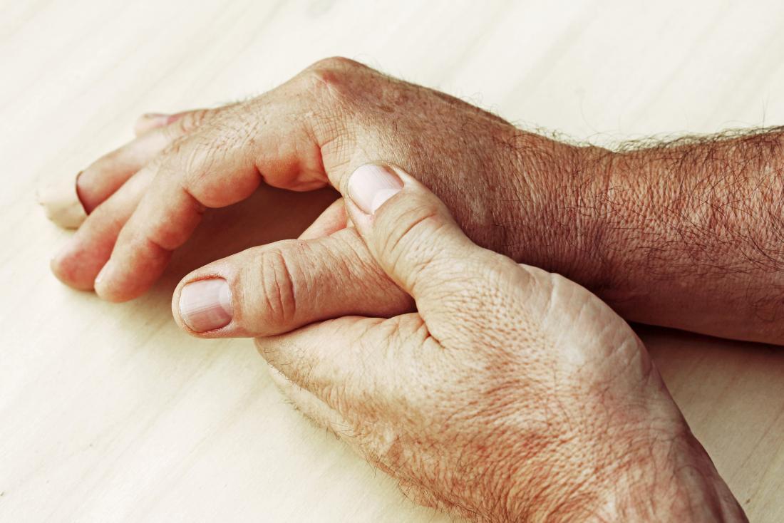 a person cannot die from ra but the associated inflammation can lead to life threatening complications