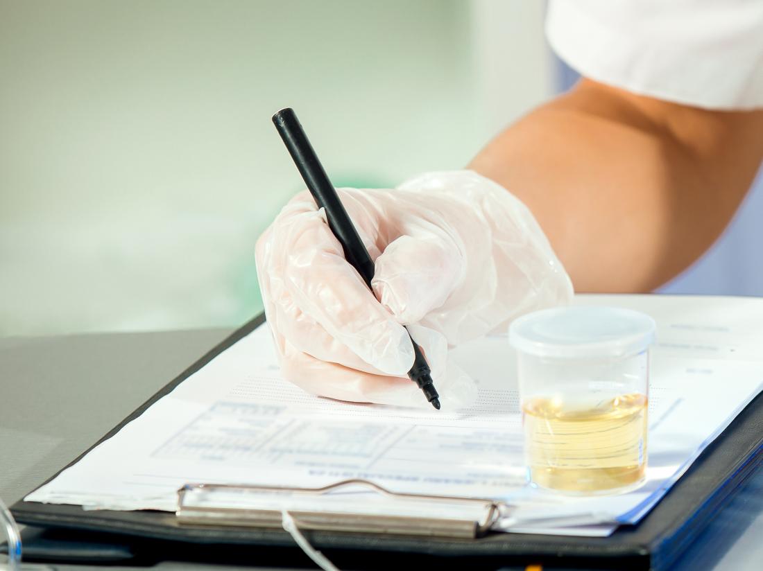 a urine test as part of a 10 panel drug test