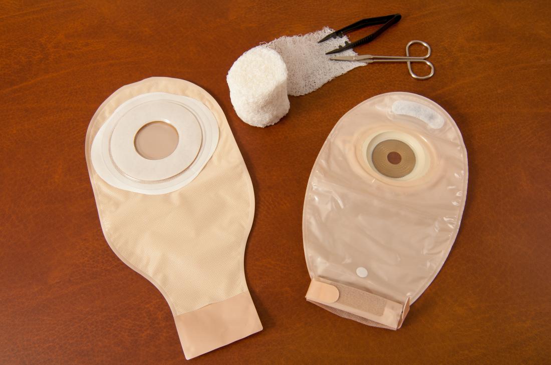 Colostomy bag: Types, uses, and living with one