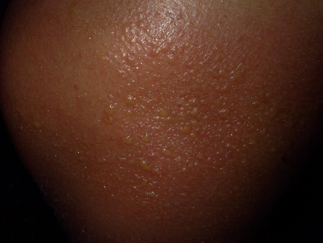 pinpoint red spots on skin