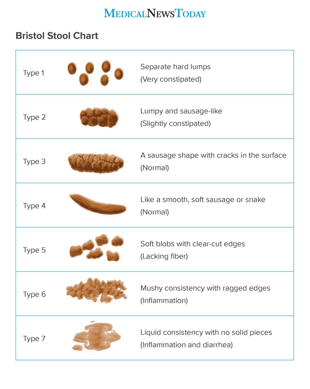 Pebble Poop Causes Remedies And When To See A Doctor