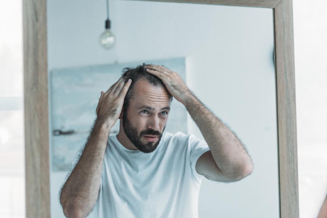 man checking for baldness in mirror