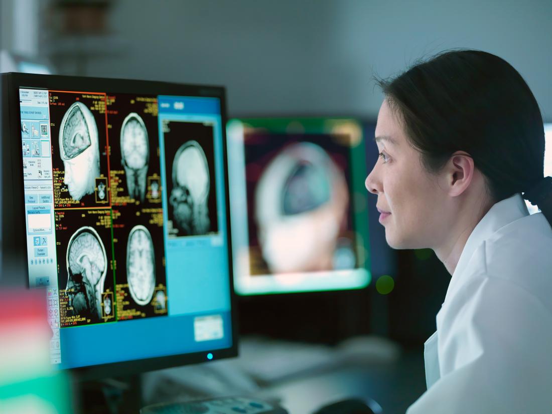 https://cdn-prod.medicalnewstoday.com/content/images/articles/326/326717/a-neurologist-looking-at-a-brain-scan.jpg