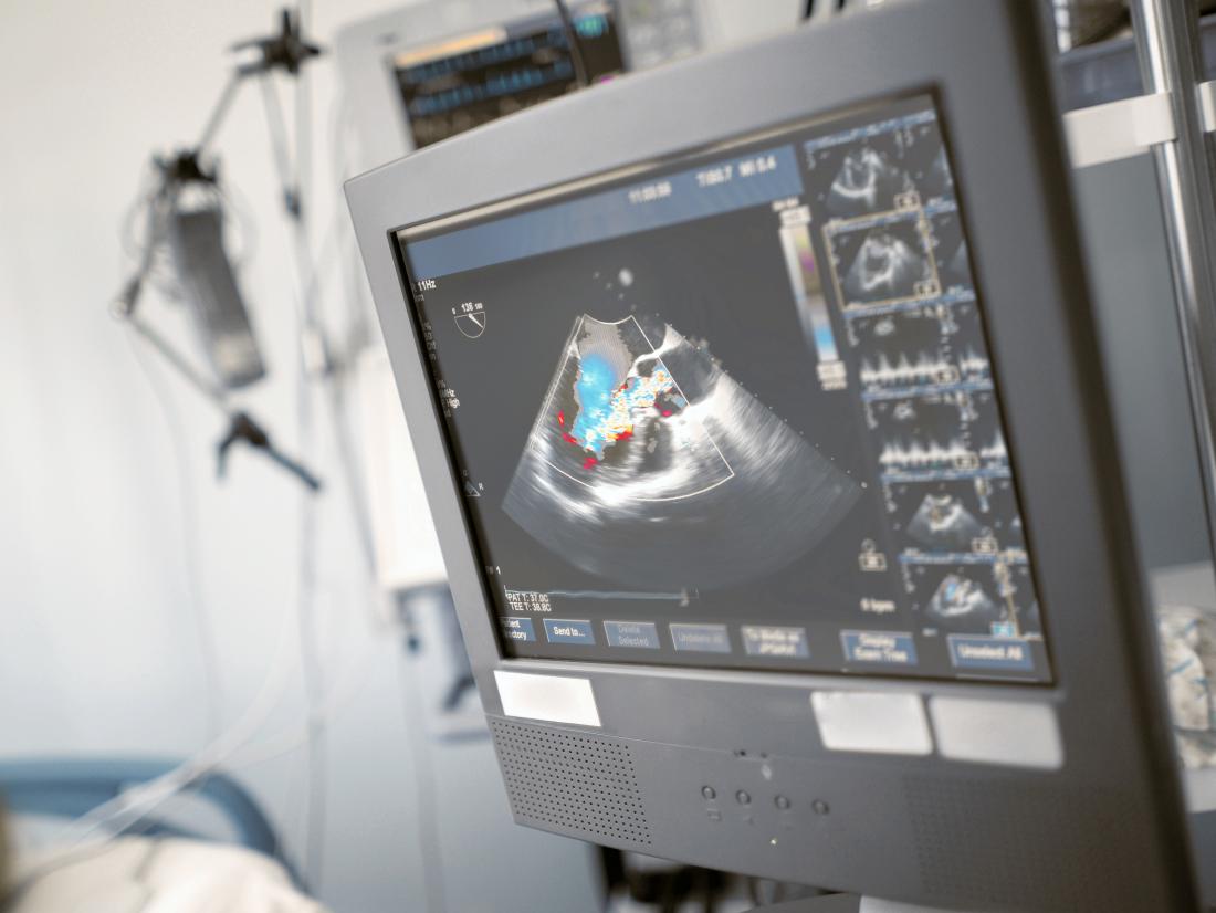 Echocardiography Machine: Overview of Echocardiography, Uses & Types