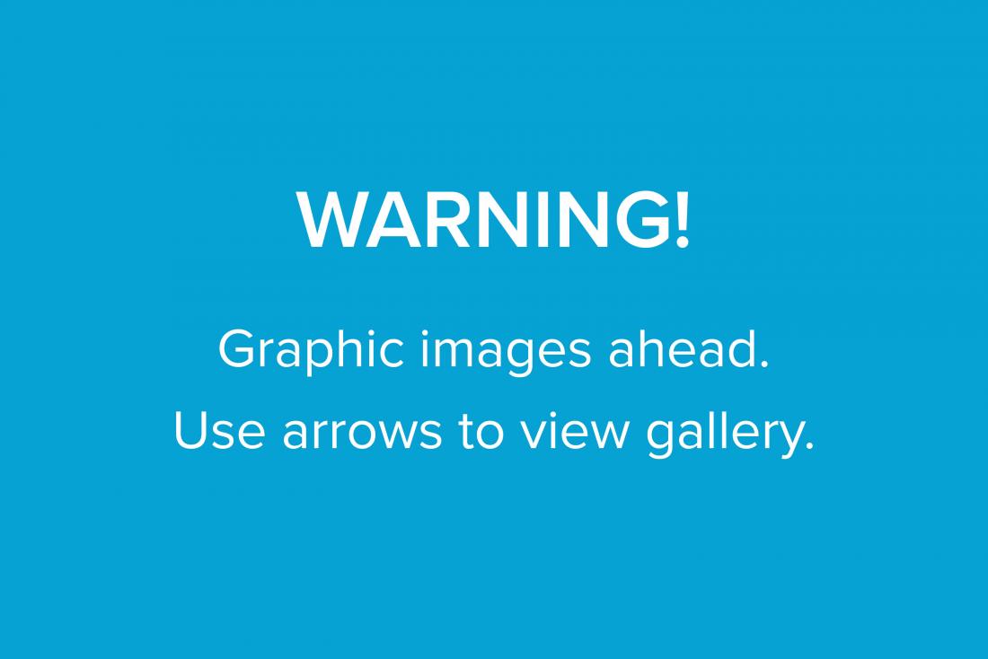 graphic warning
