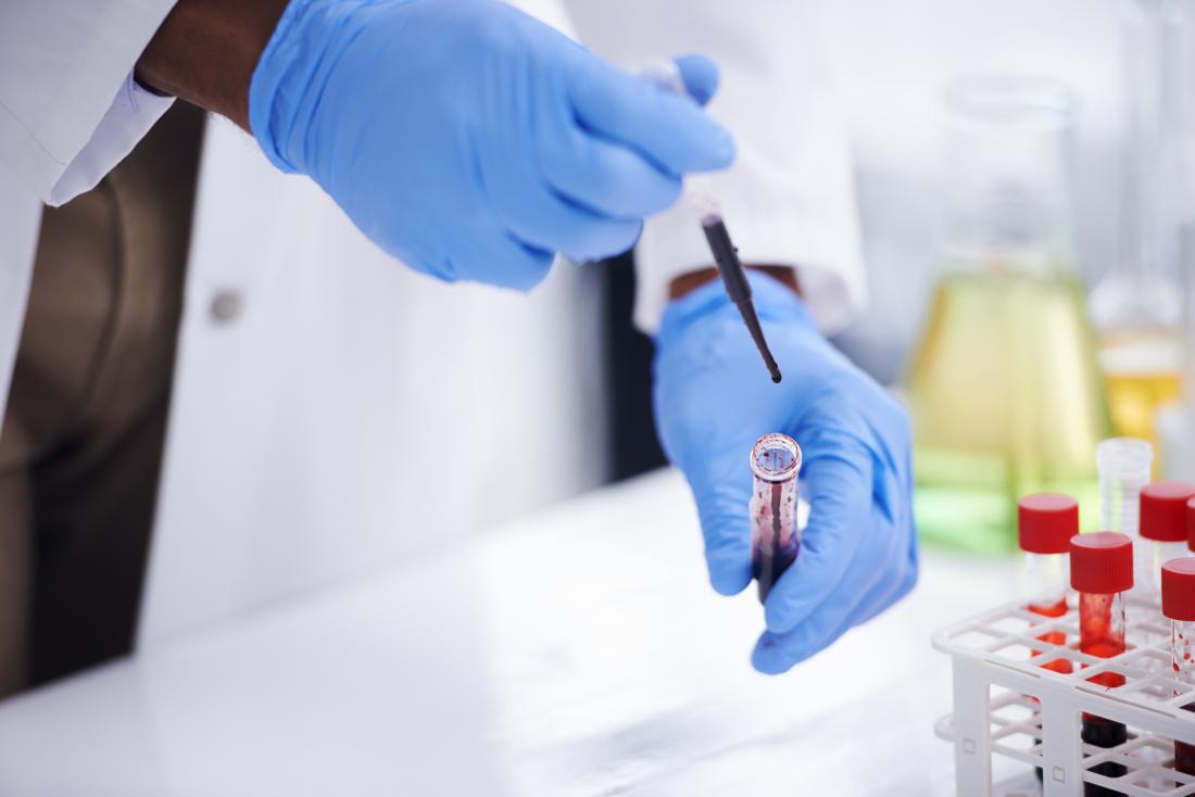 scientist testing blood in lab