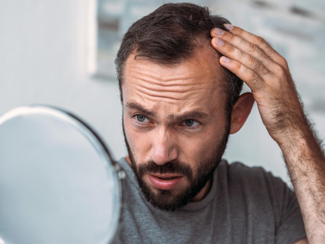 how to stop my hair from thinning