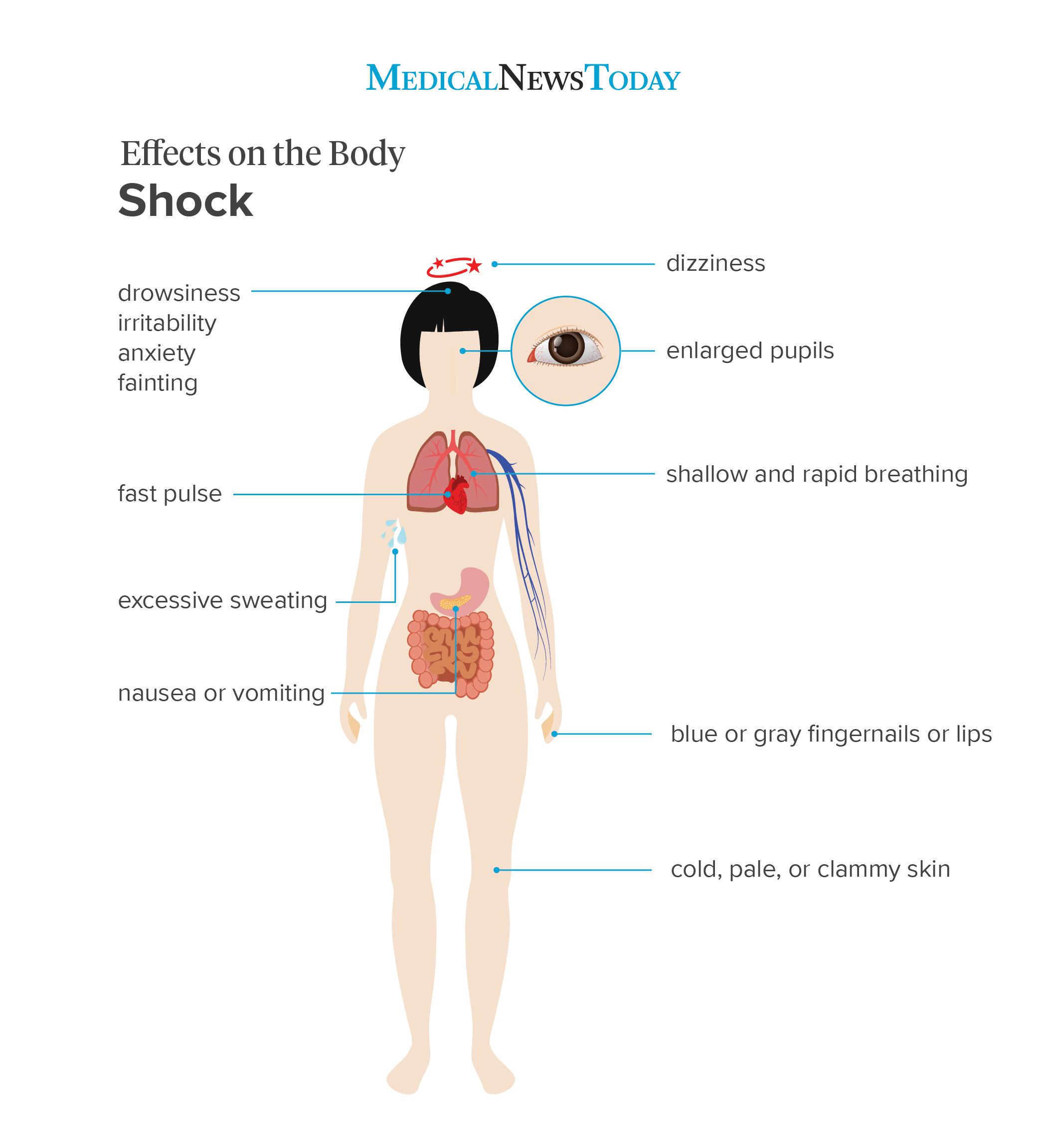 Shock: Signs, symptoms, and what to do