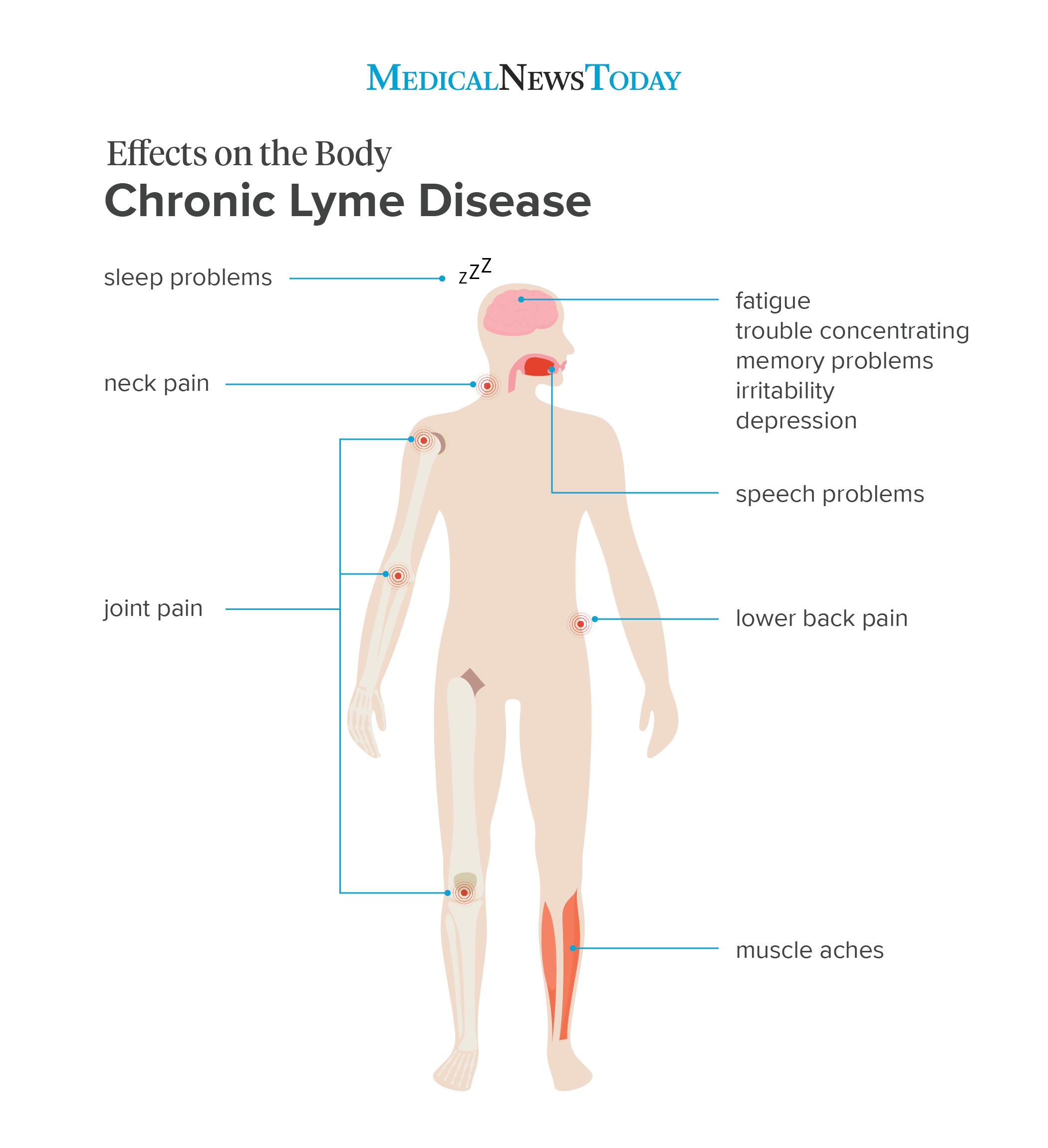 um infográfico para a doença de Lyme crônica