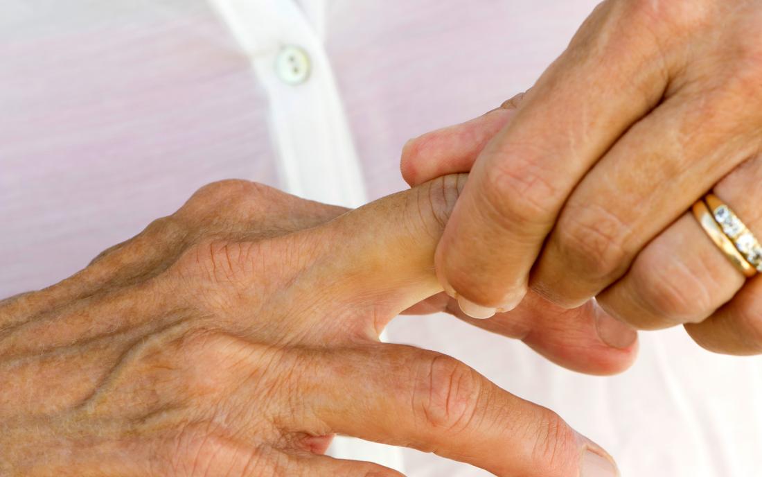 A Woman Experiencing Finger Twitching 