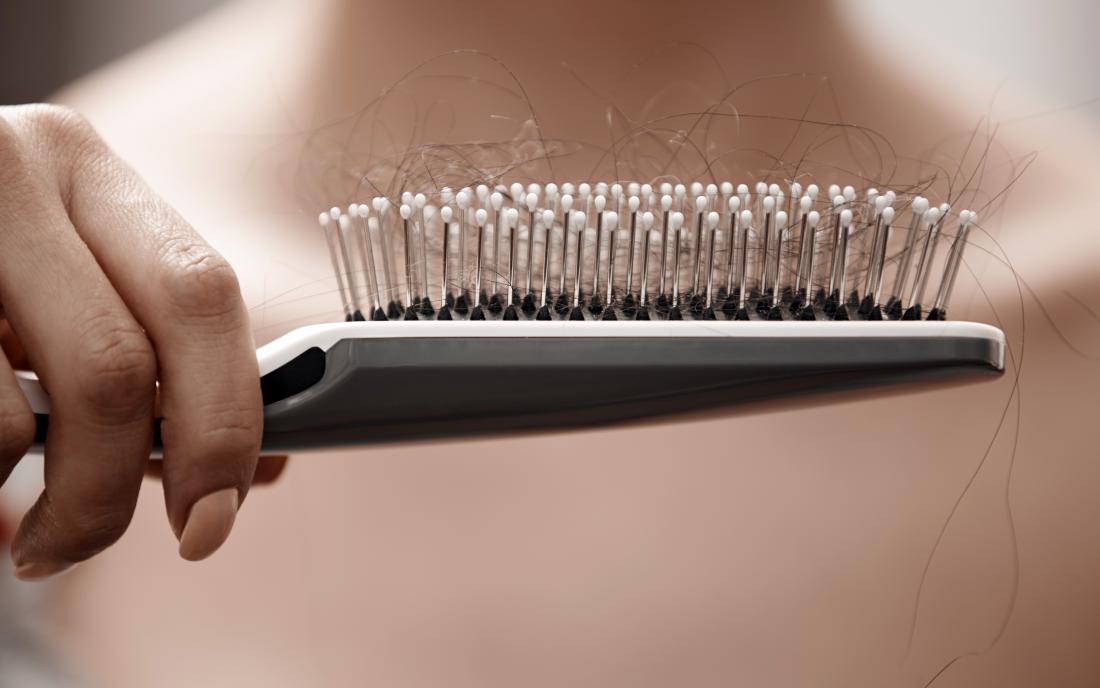 10 ways of treating female hair loss