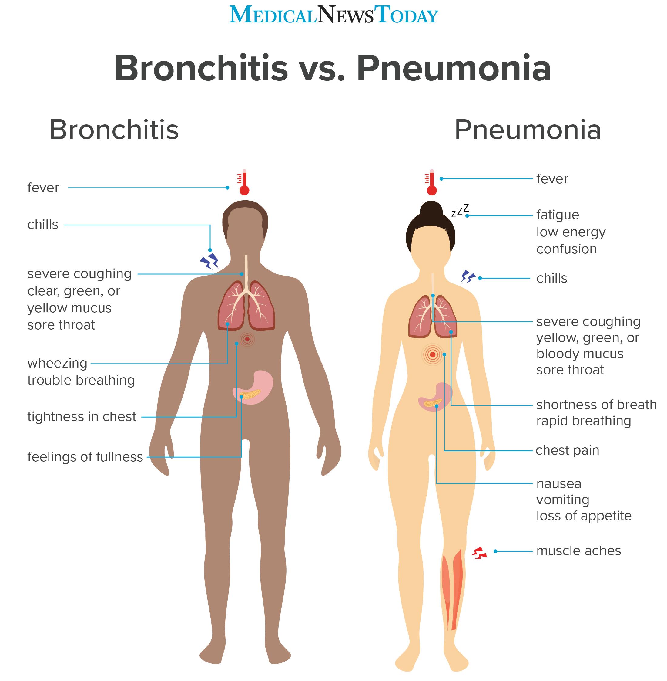 um infográfico mostrando os sintomas de bronquite vs pneumonia