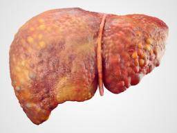 Liver Cancer Symptoms Pain