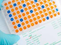 western blot test and elisa test