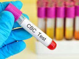 MCH levels in complete blood count tests: High and low levels