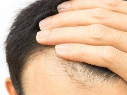 Biotin For Hair Growth Dosage And Side Effects