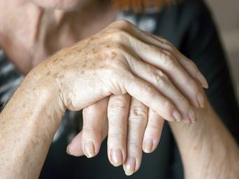 Could Vitamin D Help To Keep Rheumatoid Arthritis At Bay