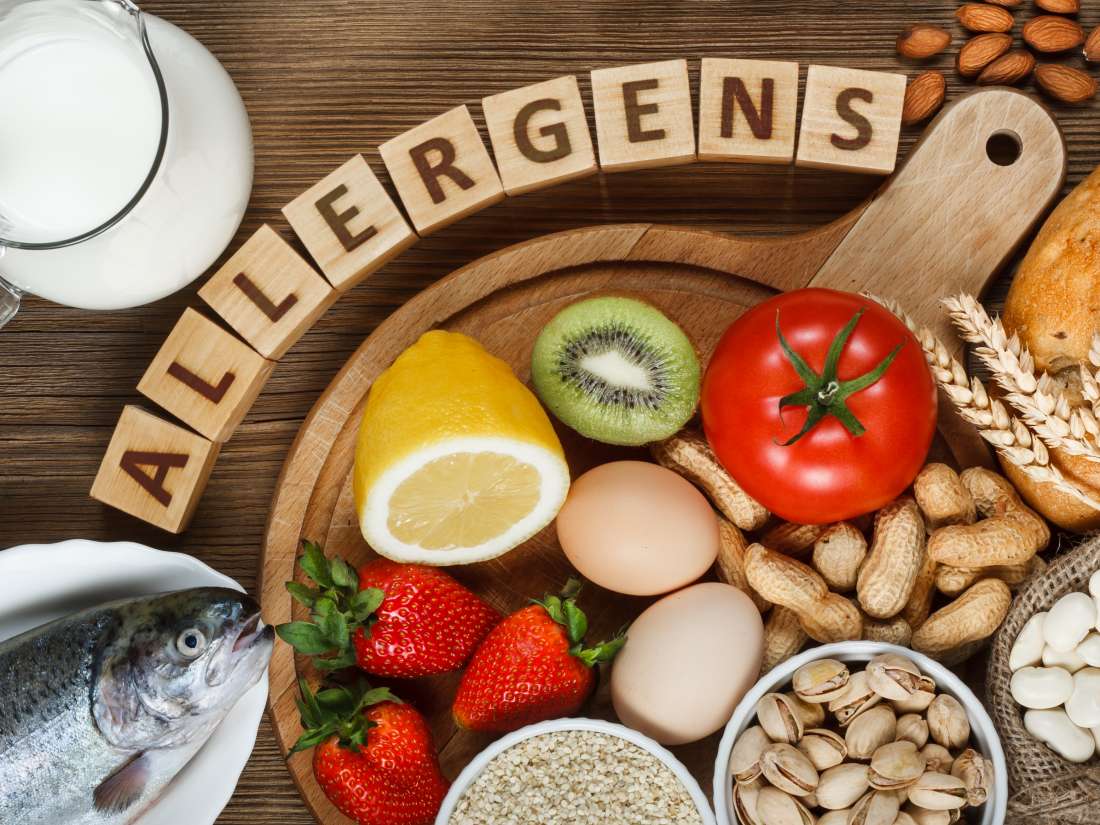 food-allergies-symptoms-treatments-and-causes