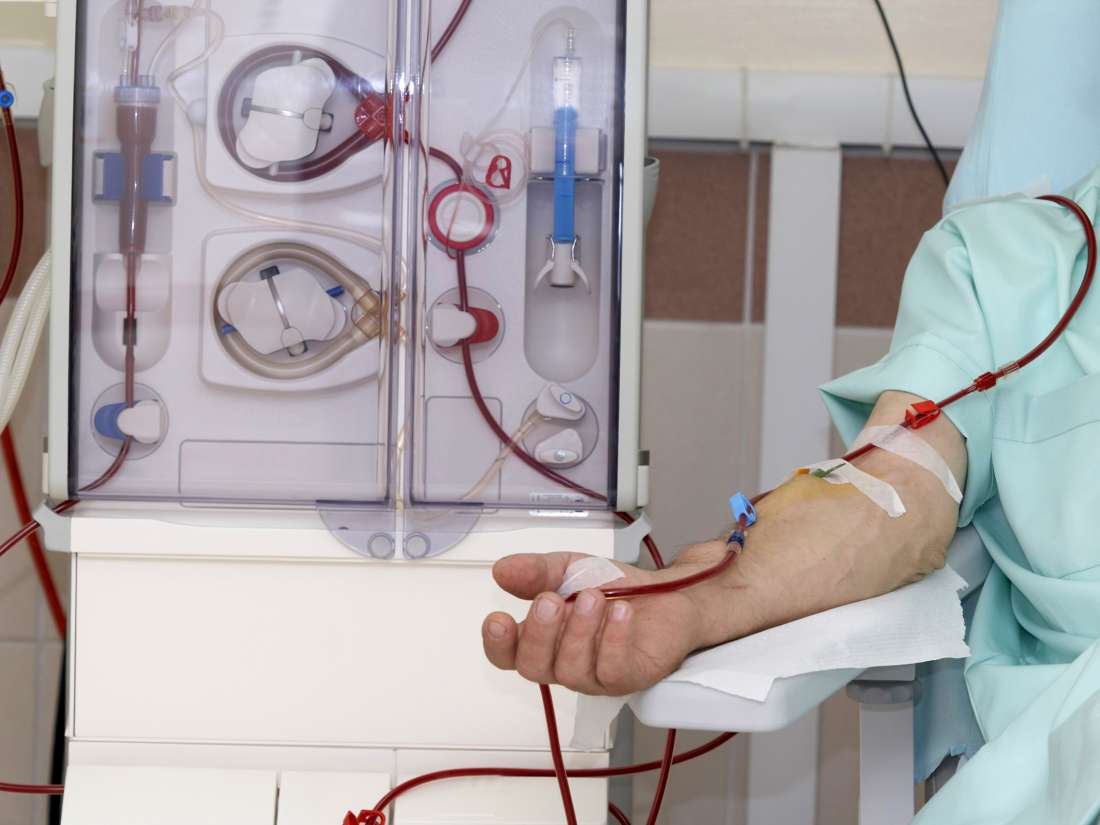 dialysis-procedure-purpose-types-side-effects-and-more
