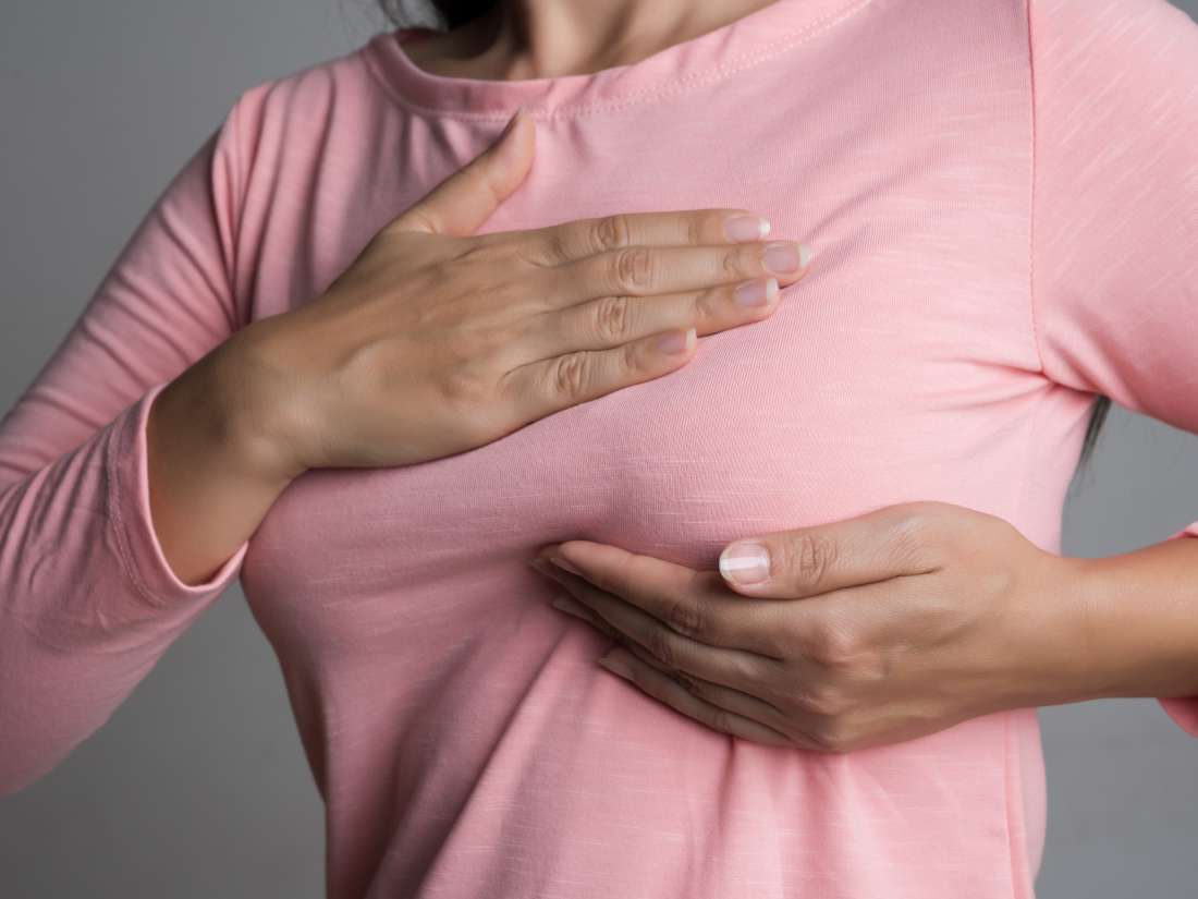 What is galactorrhea? breast discharge