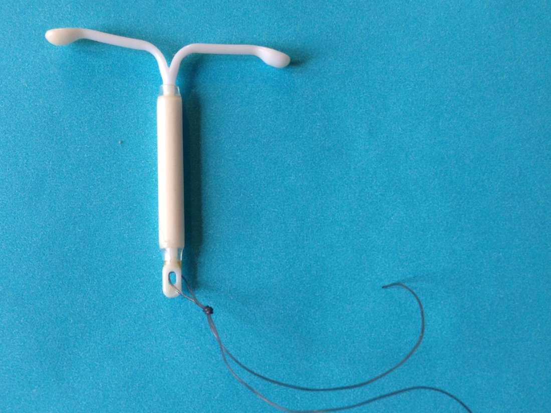 Breast cancer and Mirena IUD What's the link?