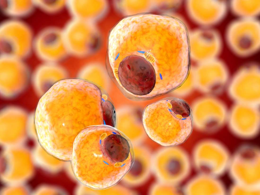 new-drug-could-shrink-harmful-fat-cells