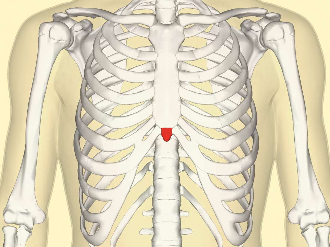Xiphoid process: Pain, lump, and removal rib  damage diagram 